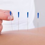akupunktur tedavisi nasıl yapılır (1)