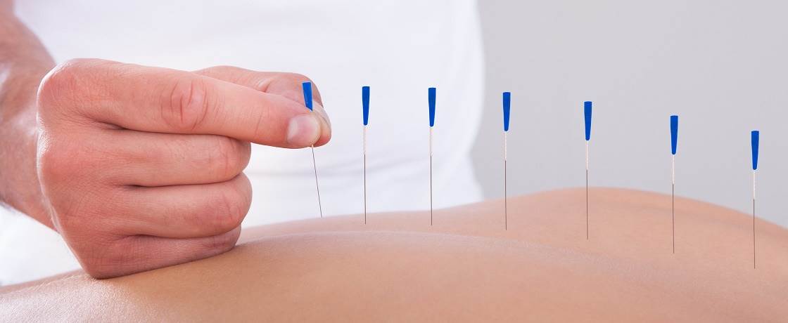 akupunktur tedavisi nasıl yapılır (1)