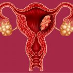 endometriyum, rahim, kadın üreme, kanser