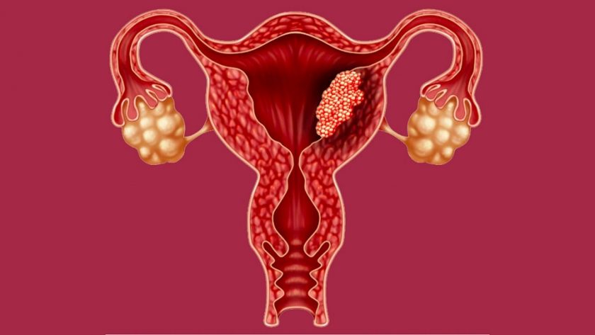 endometriyum, rahim, kadın üreme, kanser